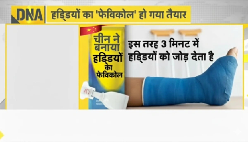 China Bone Glue: अब 3 मिनट में जुड़ेगी टूटी हड्डी, चीन ने खोजा हड्डियों का चमत्कारी 'फेविक्विक'!